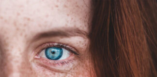 jak dbać o cerę trądzikową